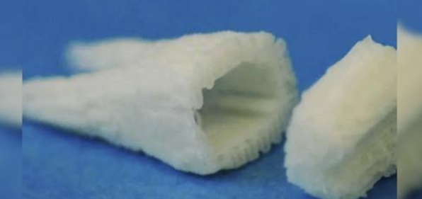 Los implantes dentales de células madre que podrían hacer crecer dientes en dos meses